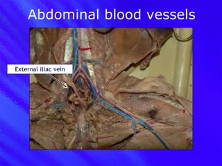 Abdominal blood vessels External iliac vein 