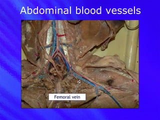 Abdominal blood vessels Femoral vein 