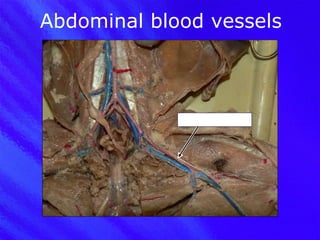 Abdominal blood vessels Femoral artery 