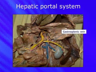 Hepatic portal system Gastrosplenic vein 