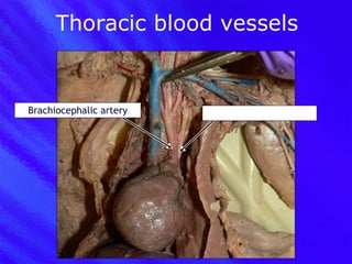 Thoracic blood vessels Brachiocephalic artery Left subclavian artery 