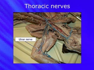 Thoracic nerves Ulnar nerve 