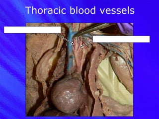 Thoracic blood vessels R common carotid artery L common carotid artery 