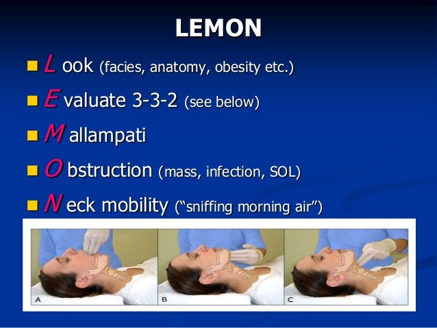 Airway management in the Emergency Department for Trainees