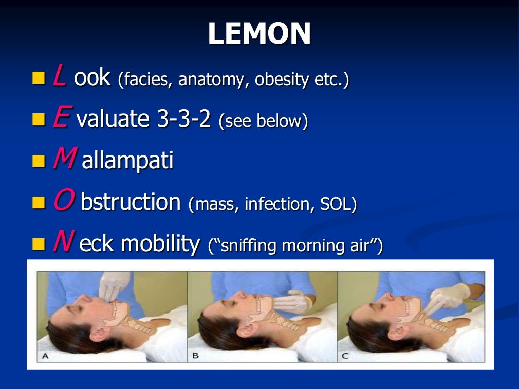 airway-management-in-the-emergency-department-for-trainees