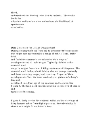 fitted,
endotracheal and feeding tubes can be inserted. The device
holds the
tubes in a stable orientation and reduces the likelihood of
spontaneous
exturbation.
Data Collection for Design Development
During development the team had to determine the dimensions
that might best accommodate a range of baby’s faces. Baby
head
and facial measurements are related to their stage of
development and to their weight. Typically, babies in the
neonatal ward
range in weight from about 1 kilogram to near 4 kilograms. The
neonatal ward includes both babies who are born prematurely
and those requiring surgery and recovery. As part of their
development effort, the team used a digital picture of a baby’s
face and
developed line drawings of the contours and features. See
Figure 3. The team used this line drawing to conceive of shapes
and
features of the device.
Figure 3. Early device development relied on line drawings of
baby features taken from digital pictures. Here the device is
shown as it might fit the infant’s face.
 