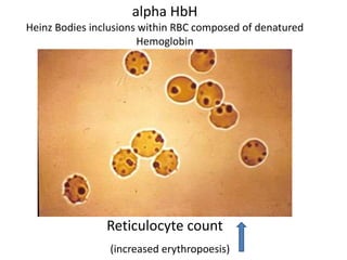 laboratory-diagonosis-thalassemia-chirantan-pptx