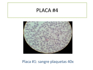 PLACA #4
Placa #1: sangre plaquetas 40x
 
