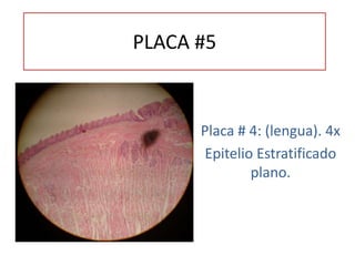 PLACA #5
Placa # 4: (lengua). 4x
Epitelio Estratificado
plano.
 