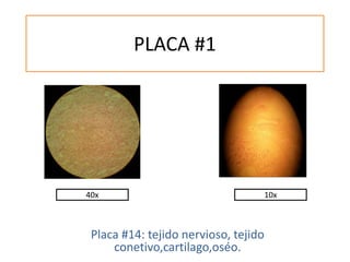 PLACA #1
Placa #14: tejido nervioso, tejido
conetivo,cartilago,oséo.
40x 10x
 