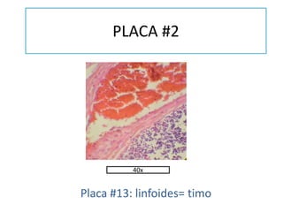 PLACA #2
Placa #13: linfoides= timo
40x
 