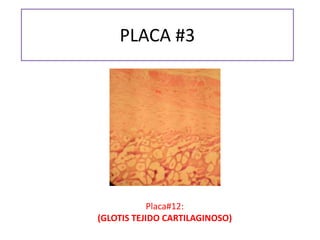 PLACA #3
Placa#12:
(GLOTIS TEJIDO CARTILAGINOSO)
 