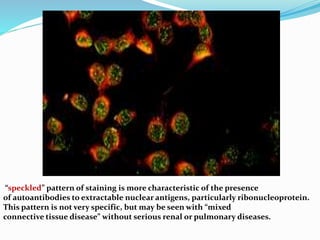 Lab diagnosis autoimmune disease | PPTX