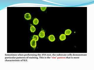 Lab diagnosis autoimmune disease | PPTX