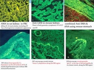 Lab diagnosis autoimmune disease | PPTX