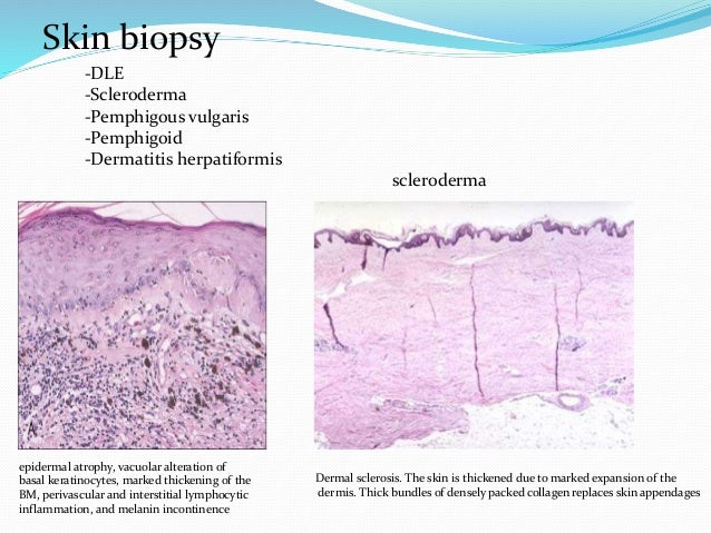 Lab Diagnosis Autoimmune Disease