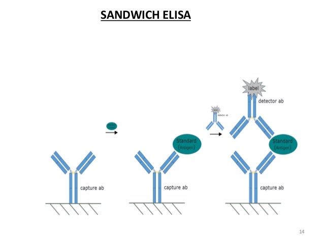 lab diagnosis hiv elisa lab