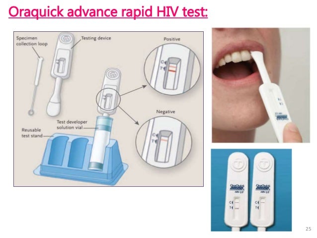 hiv orale test Lab hiv diagnosis hiv orale test Lab hiv diagnosis