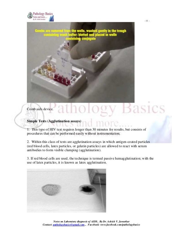 LABORATORY DIAGNOSIS OF HIV AIDS