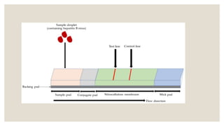 Lab diagnosis of hepatitis | PPTX