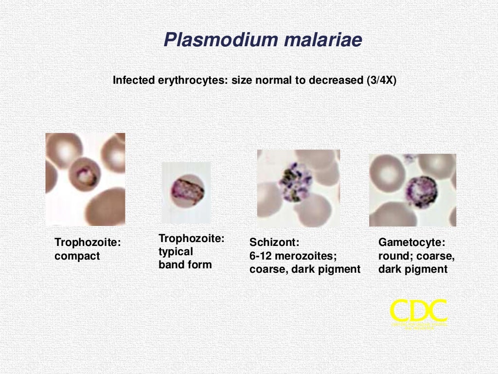 Lab diagnosis of malaria