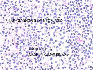 LAB DIAGNOSIS OF NEOPLASIA 
PRESENTED BY: 
MADHUR KUMAR SEJWAL 
 