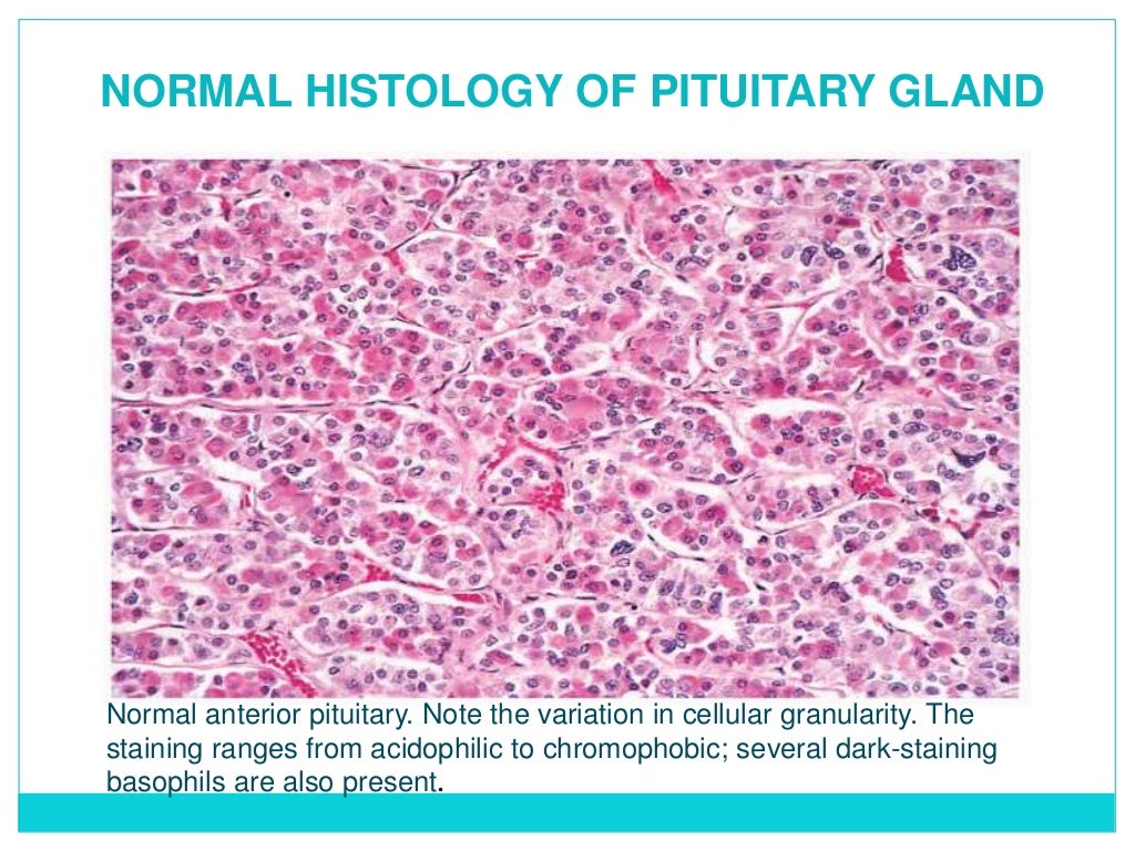 Lab diagnosis of pituitary tumors