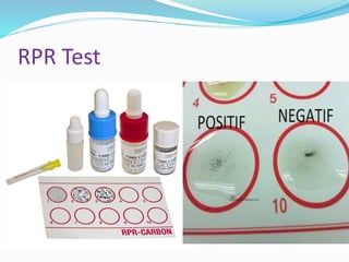 Std Test Algorithm Rpr Lab diagnosis of Sexually transmitted Infections (STIs) | PPTX