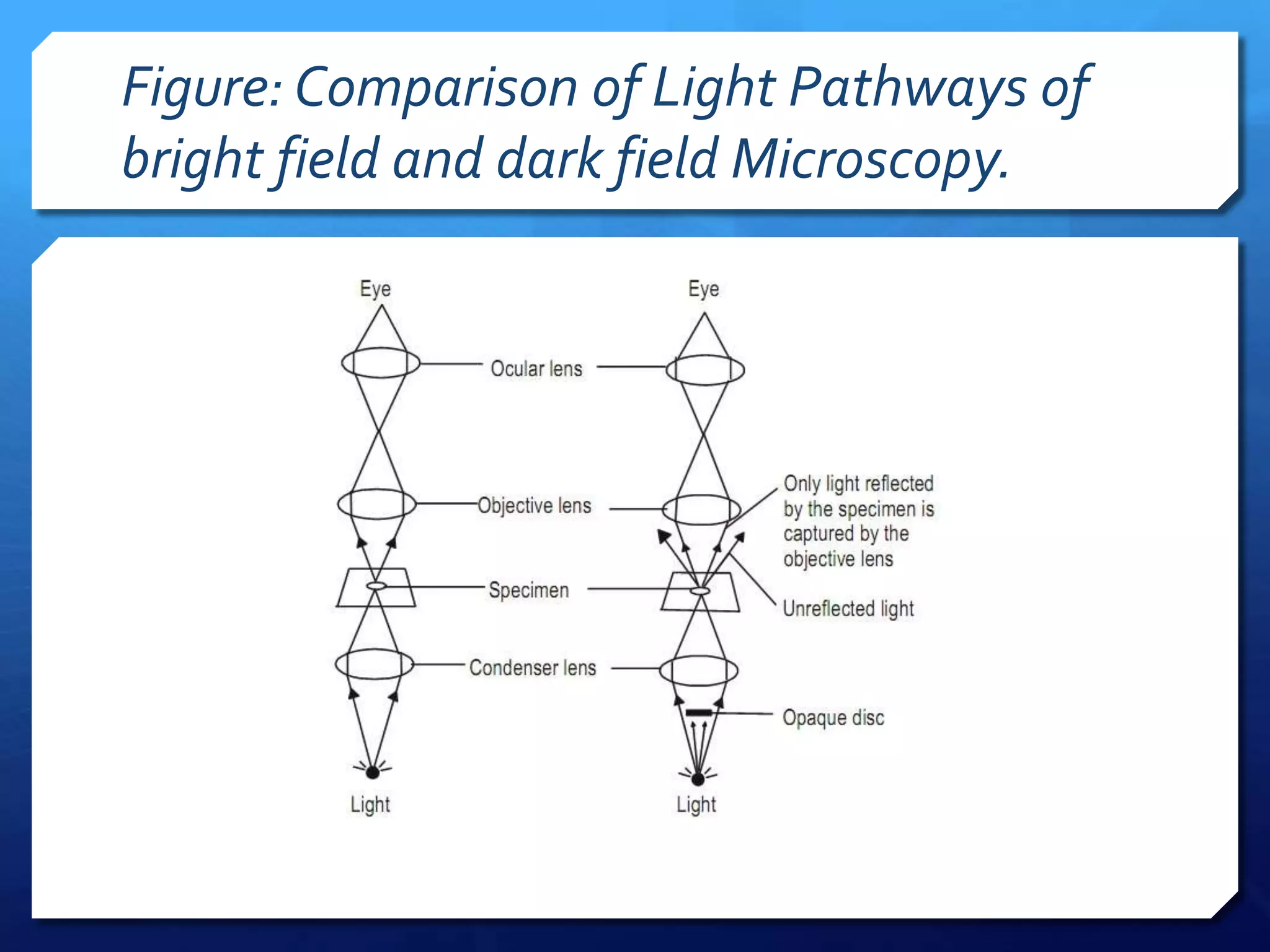Figure: Comparison of Light Pathways of
bright field and dark field Microscopy.

 