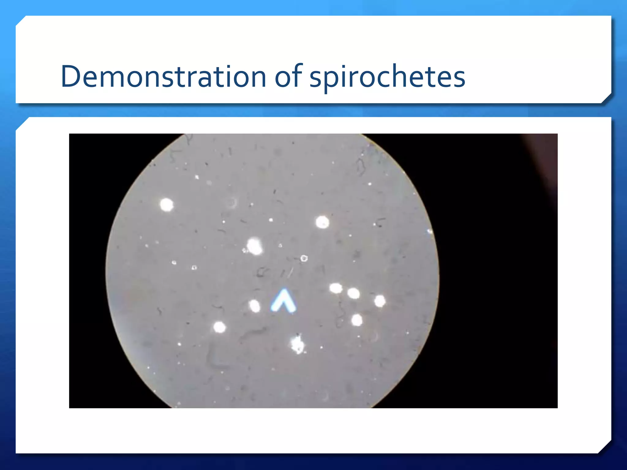 Demonstration of spirochetes

 