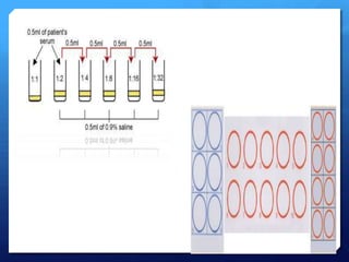 Syphilis Load Lab diagnosis of syphilis | PPTX