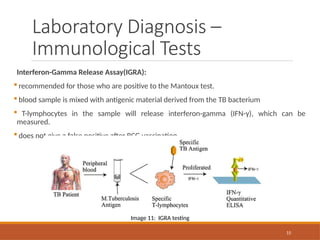 laboratory diagnosis of Tuberculosis.pptx