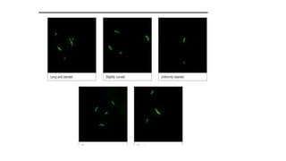 Lab Genetics Tuberculosis LAB DIAGNOSIS OF TUBERCULOSIS.pptx