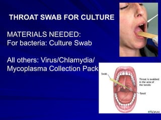 THROAT SWAB FOR CULTURE
MATERIALS NEEDED:
For bacteria: Culture Swab
All others: Virus/Chlamydia/
Mycoplasma Collection Pack
 