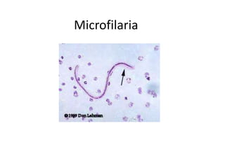 Microlaria Microscope Lab dia of parasite | PPTX