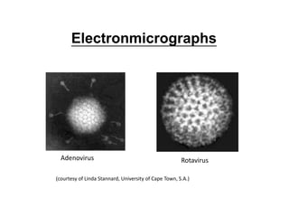 Electronmicrographs
Adenovirus Rotavirus
(courtesy of Linda Stannard, University of Cape Town, S.A.)
 