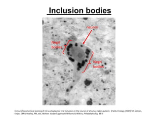 Inclusion bodies
Negri
bodies
Negri
bodies
neuron
Immunohistochemical staining of intra-cytoplasmic viral inclusions in the neuron of a human rabies patient. (Fields Vriology (2007) 5th edition,
Knipe, DM & Howley, PM, eds, Wolters Kluwer/Lippincott Williams & Wilkins, Philadelphia Fig. 39.9)
 