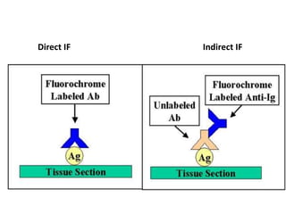 Direct IF Indirect IF
 