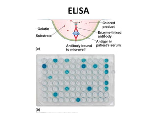 ELISA
 