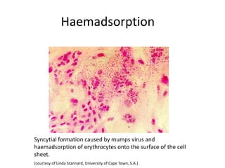 Haemadsorption
Syncytial formation caused by mumps virus and
haemadsorption of erythrocytes onto the surface of the cell
sheet.
(courtesy of Linda Stannard, University of Cape Town, S.A.)
 