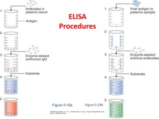 ELISA
Procedures
Figure 5-19a
Modified from Specter, S. C., R. L. Hodinka and S. A. Young. Clinical Virology Manual, Third
Edition . ASM Press, 2000.
Figure 5-19b
 