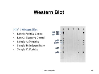 Western Blot
HIV-1 Western Blot
• Lane1: Positive Control
• Lane 2: Negative Control
• Sample A: Negative
• Sample B: Indeterminate
• Sample C: Positive
Dr.T.V.Rao MD 48
 