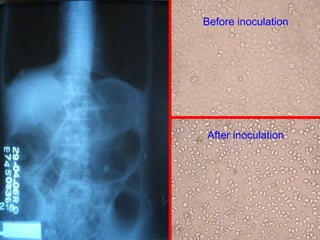 Grex Inoculation Labdx g iinfection_print | PDF