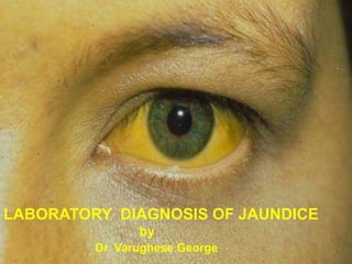 LABORATORY DIAGNOSIS OF
JAUNDICE
by
Dr. Varughese George
LABORATORY DIAGNOSIS OF JAUNDICE
by
Dr. Varughese George
 