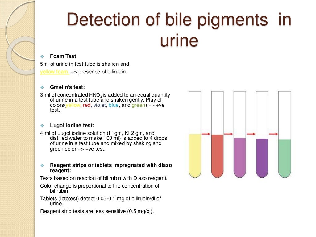 Laboratory Diagnosis of Jaundice