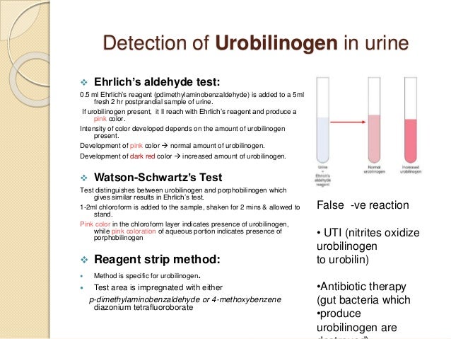 sample positive pregnancy result test Laboratory Jaundice of Diagnosis sample positive pregnancy result test Laboratory Jaundice of Diagnosis
