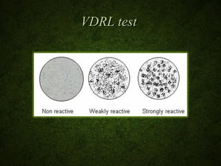 Srdl Lab Lab diagnosis of syphilis | PPT