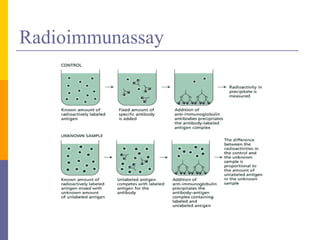 Radioimmunassay
 