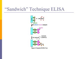 “Sandwich” Technique ELISA
 