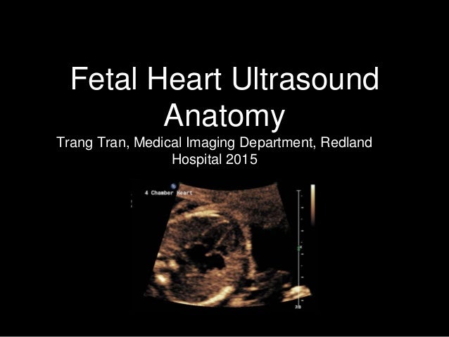 Fetal Heart Ultrasound